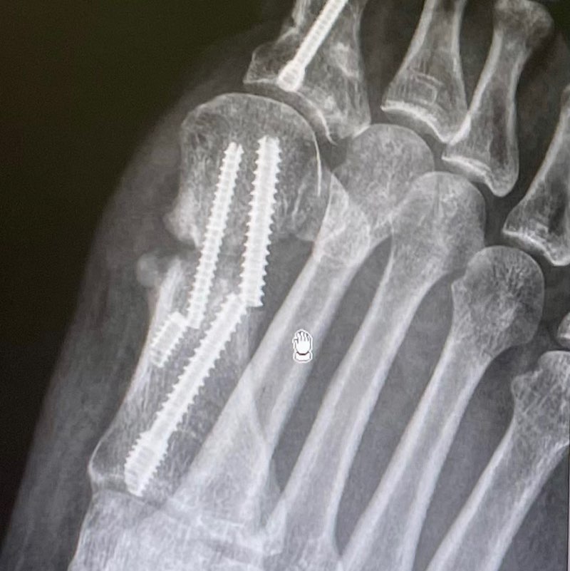 Paul Williams 🇬🇧🚶🏻‍♂️⛳️🏌️‍♂️🏃🏻‍♂️🚴🏻 🏴󠁧󠁢󠁥󠁮󠁧󠁿🏴󠁧󠁢󠁷󠁬󠁳󠁿🏴󠁧󠁢󠁳󠁣󠁴󠁿🇮🇪