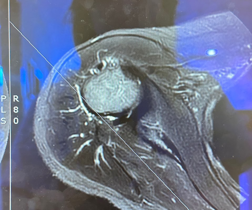 放射科陳欣儀310570