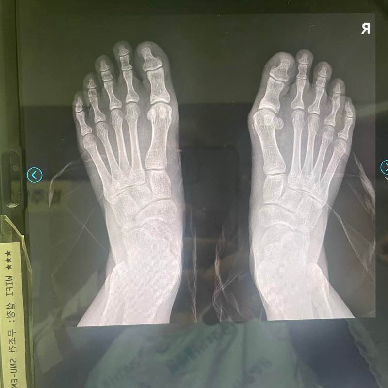 For Right of 🇵🇸 post 2