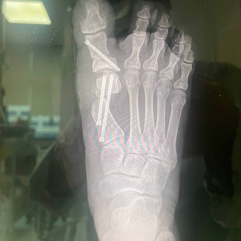 For Right of 🇵🇸 post 3