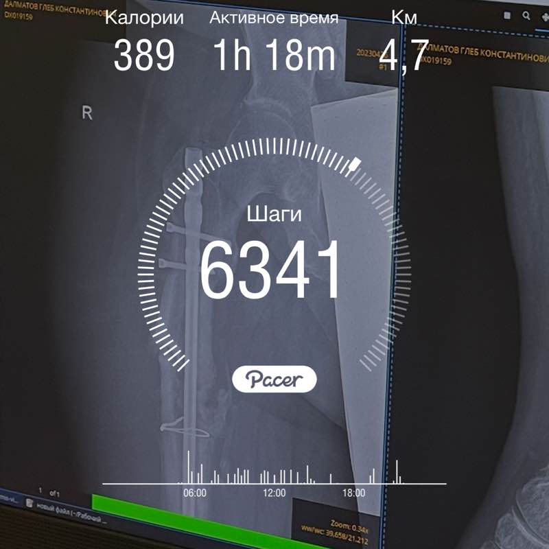 Gleb Dalmatov post 1