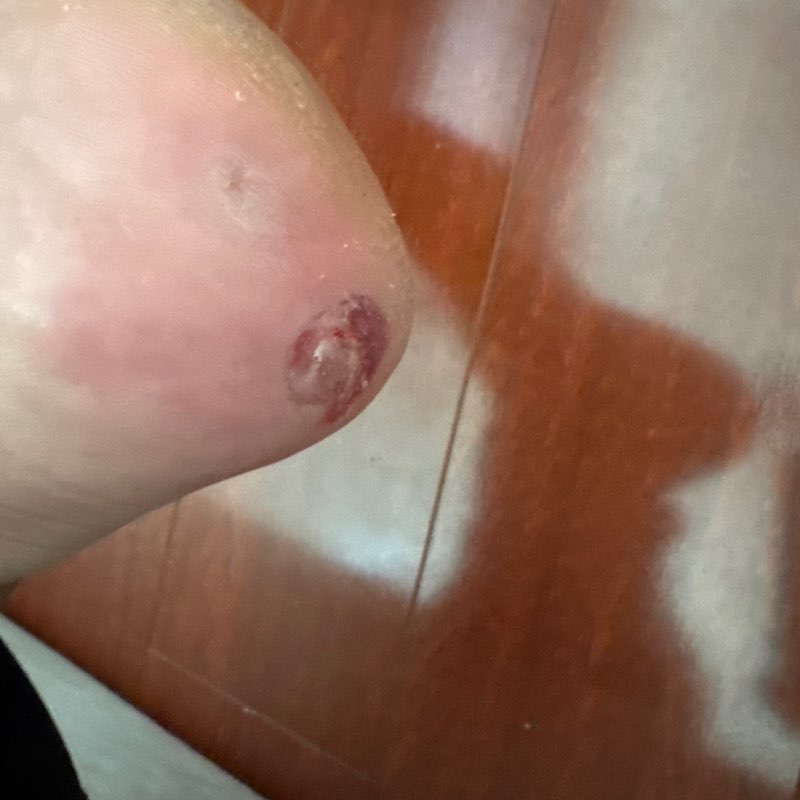 Vince 10 Miles Daily post 1