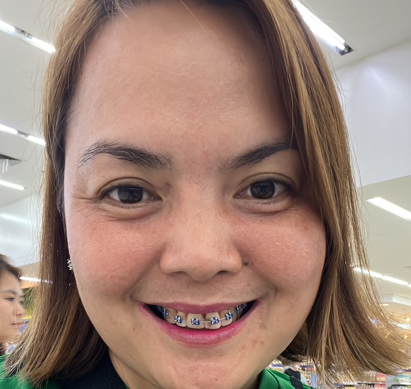 Siyete Cabuscabus AcuEza