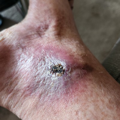 Rovert Travis Moose post 2