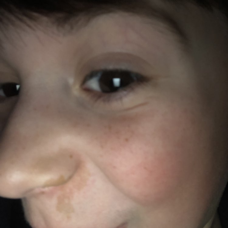 void géométrie post 1