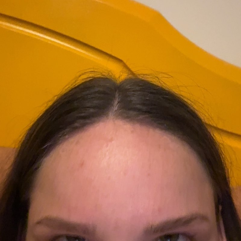 Enahanced Steppers Vitalé post image