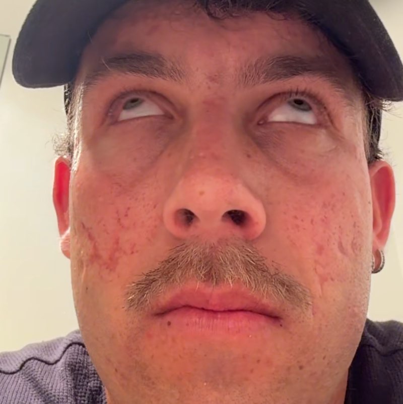 Enahanced Steppers Chelsea post image