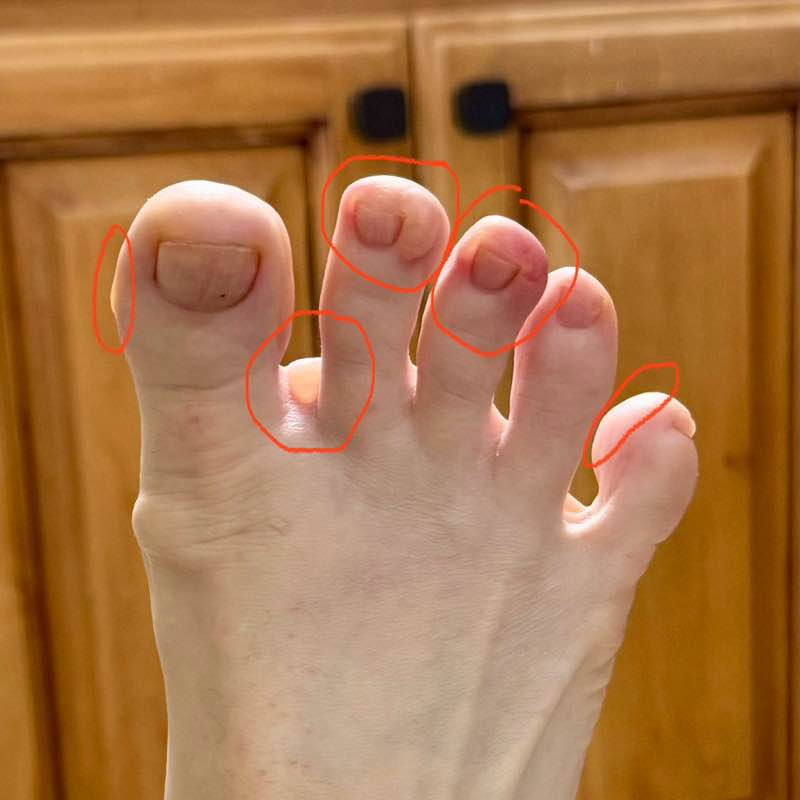 Stacylyn Burnett post 1