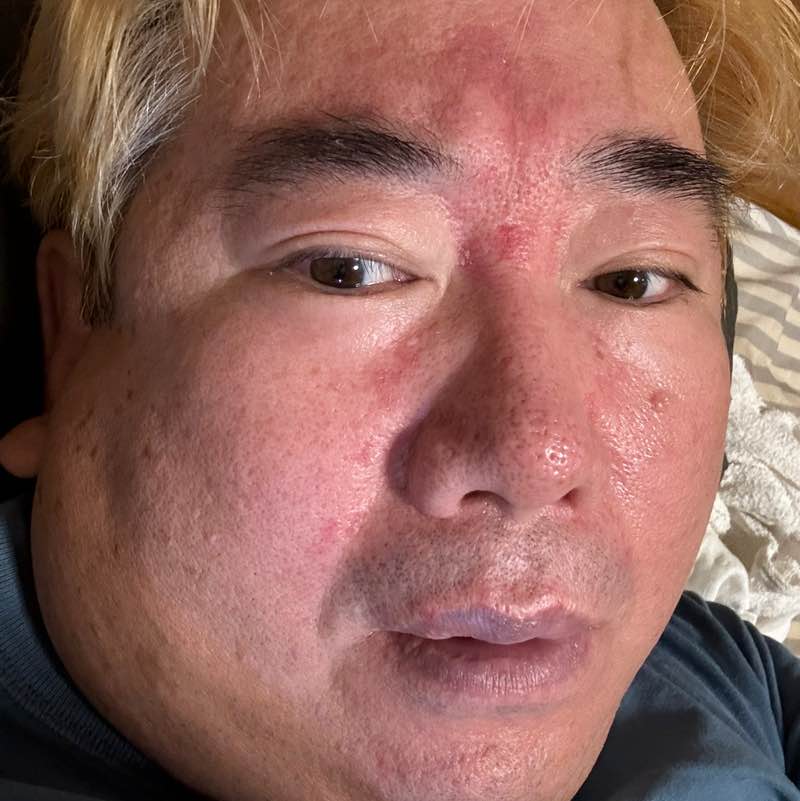 やせた～い🐷 実 post image