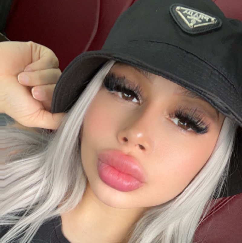 CYN
