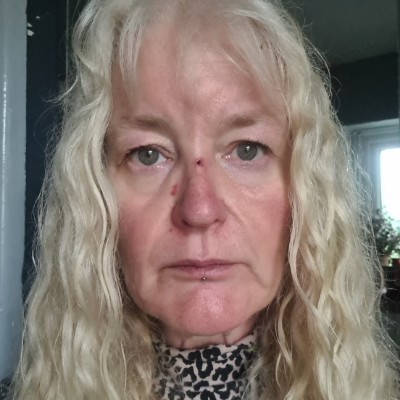 Fibro Warriors 💜 Denise Frain post image