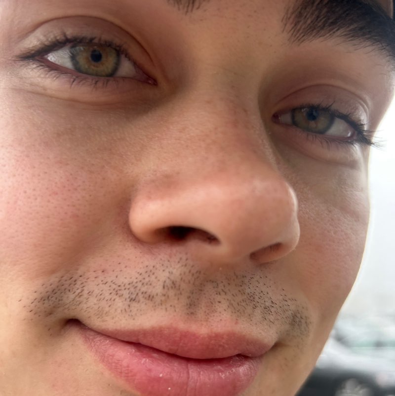 Todd profile