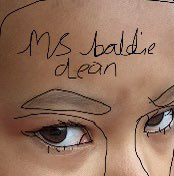 ms baldie dean profile