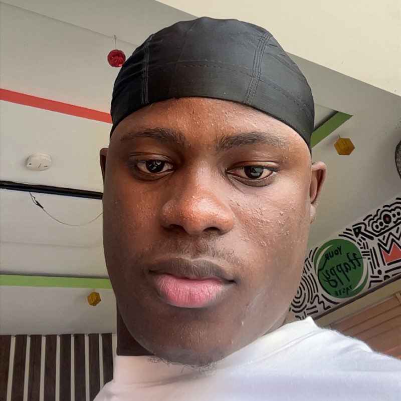 Akin profile