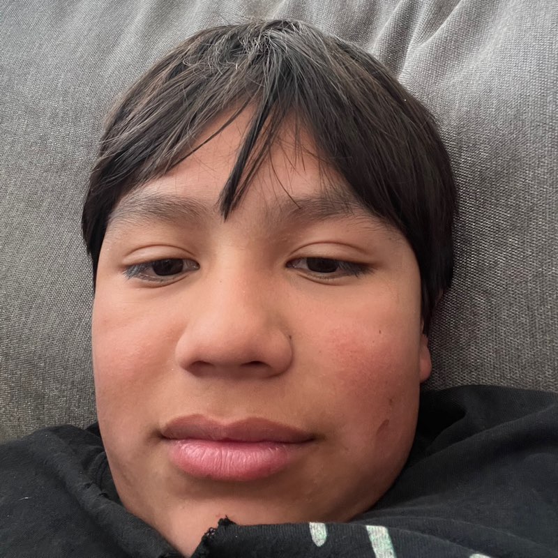 Noe profile