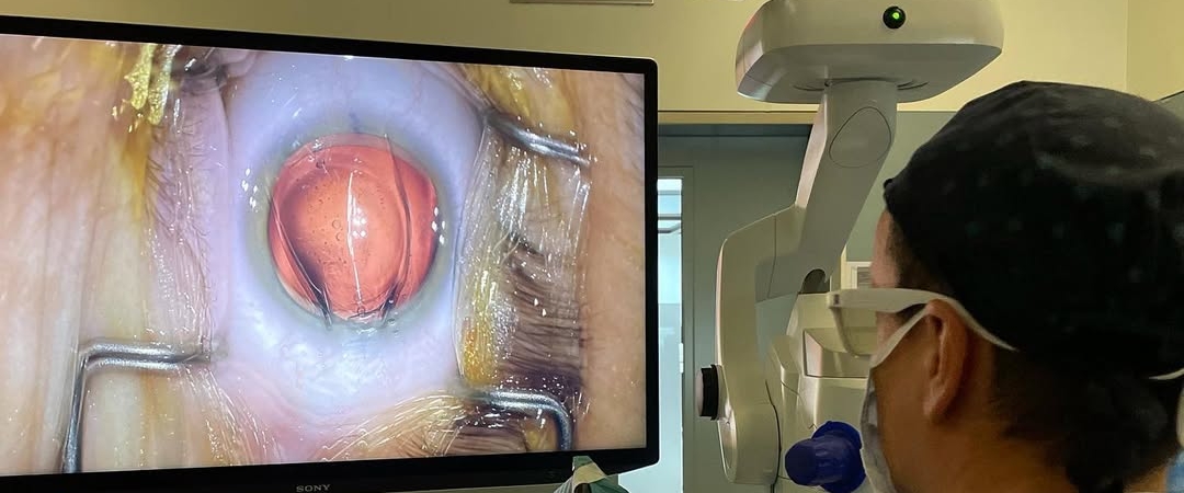 Eye Clinic Worldeye (Dünyagöz) banner