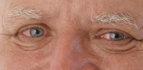 тест группа banner