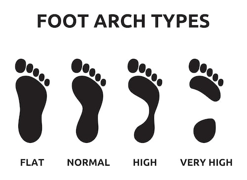 Flat, normal, high and very high arch types