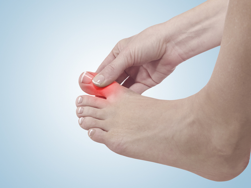 Toe injury graphic concept