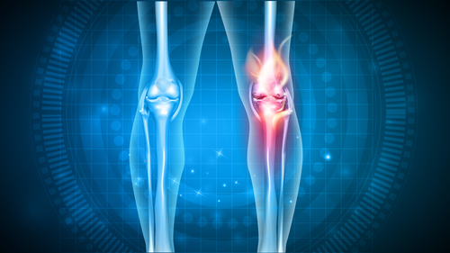 Healthy and injured knees - knee health concept