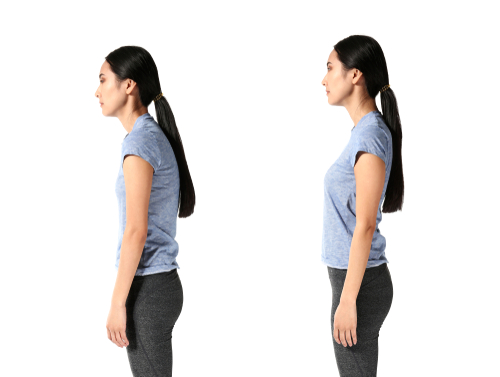 Woman with bad and good walking posture